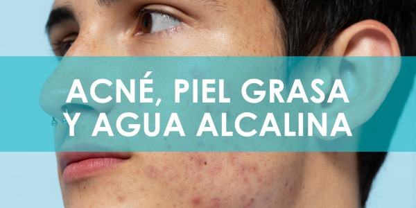 Acné, piel grasa y agua alcalina. Beneficios y efectos.