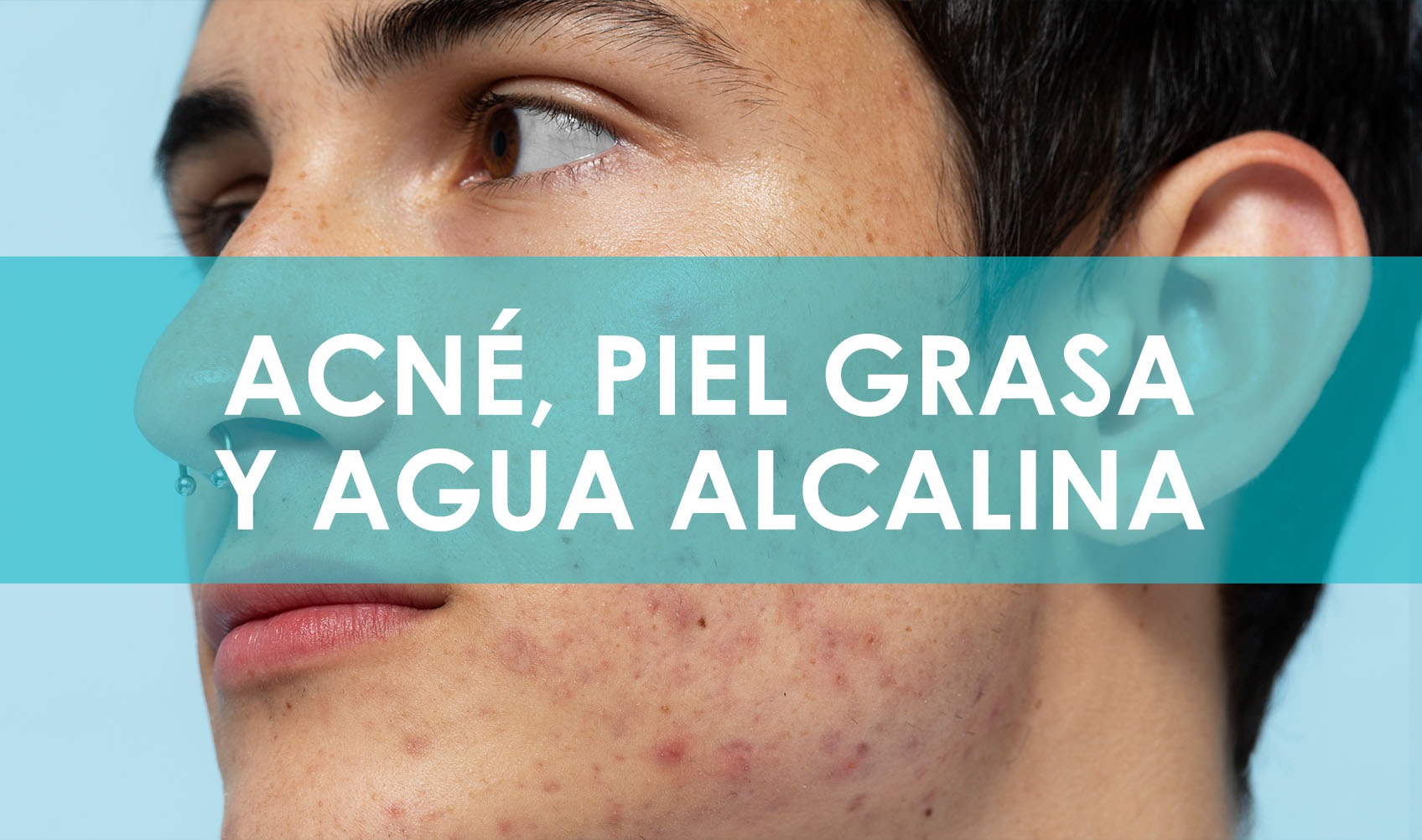 Acné, piel grasa y agua alcalina. Beneficios y efectos.